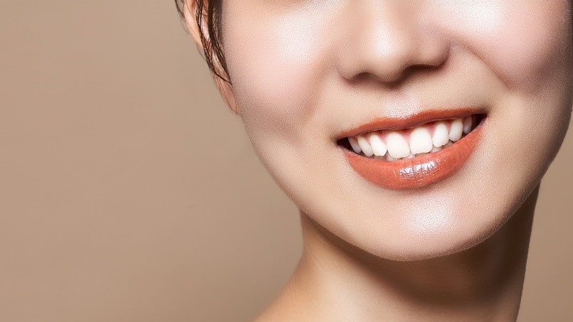 芸能人の美しい歯は全部インプラント？選ばれる理由と代わりの治療法