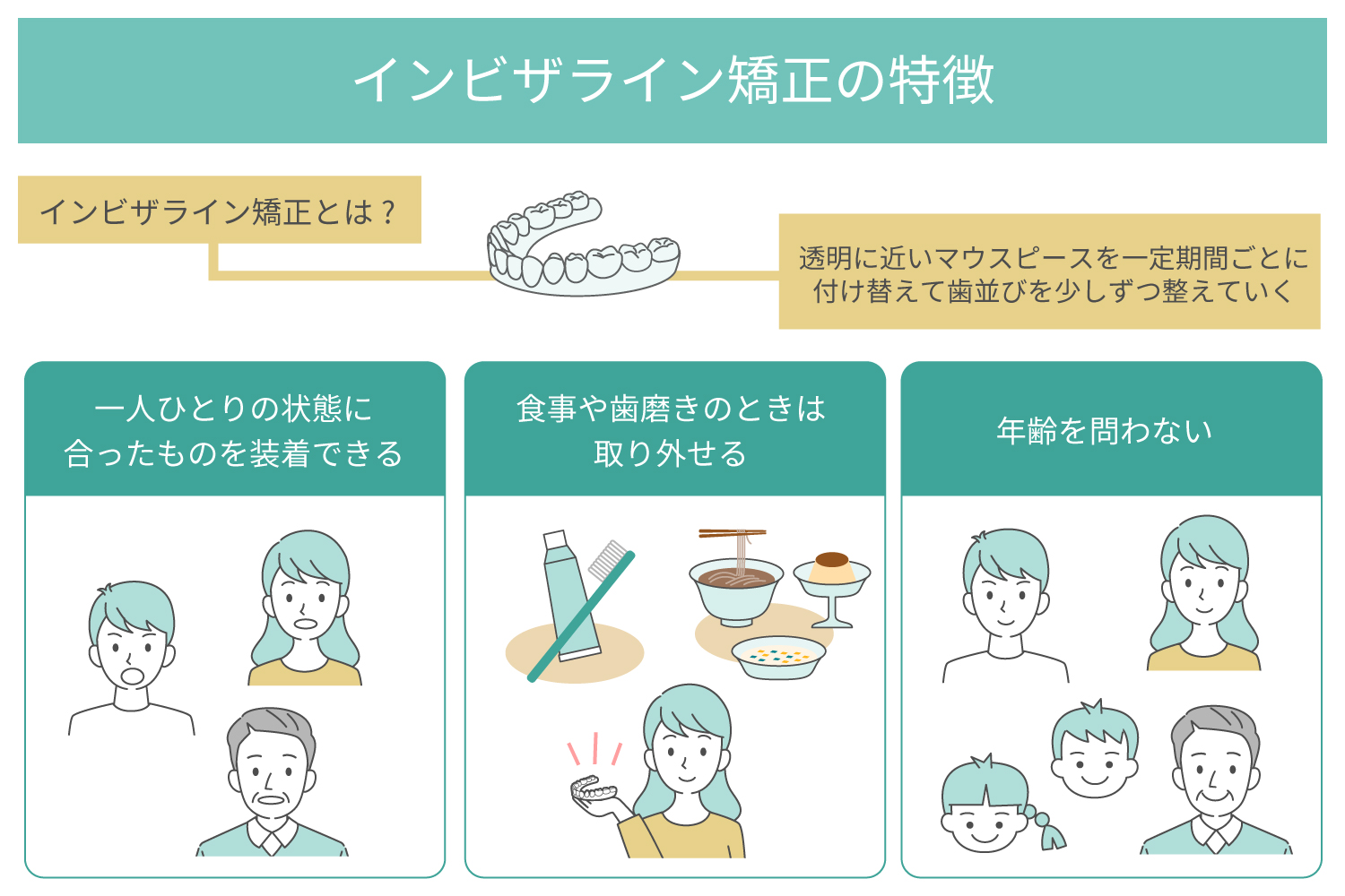 インビザライン矯正の特徴