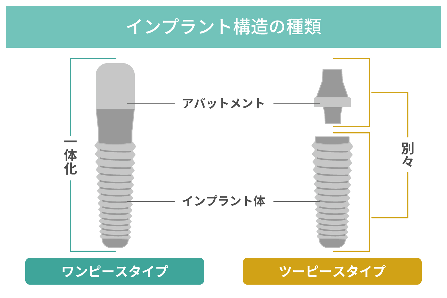 インプラントの構造の種類