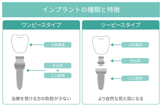 ②アバットメント：インプラント体と人工歯をつなぐ「連結部分」