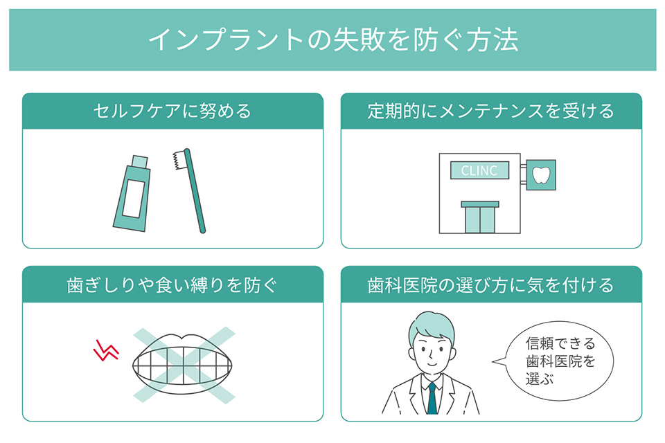 インプラントの失敗を防ぐには