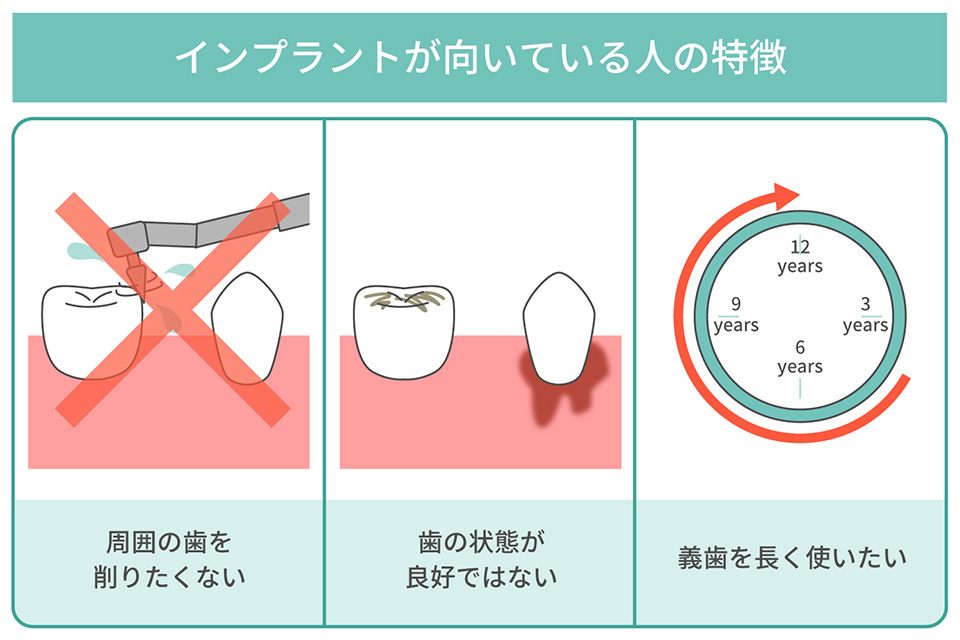インプラントが向いている人