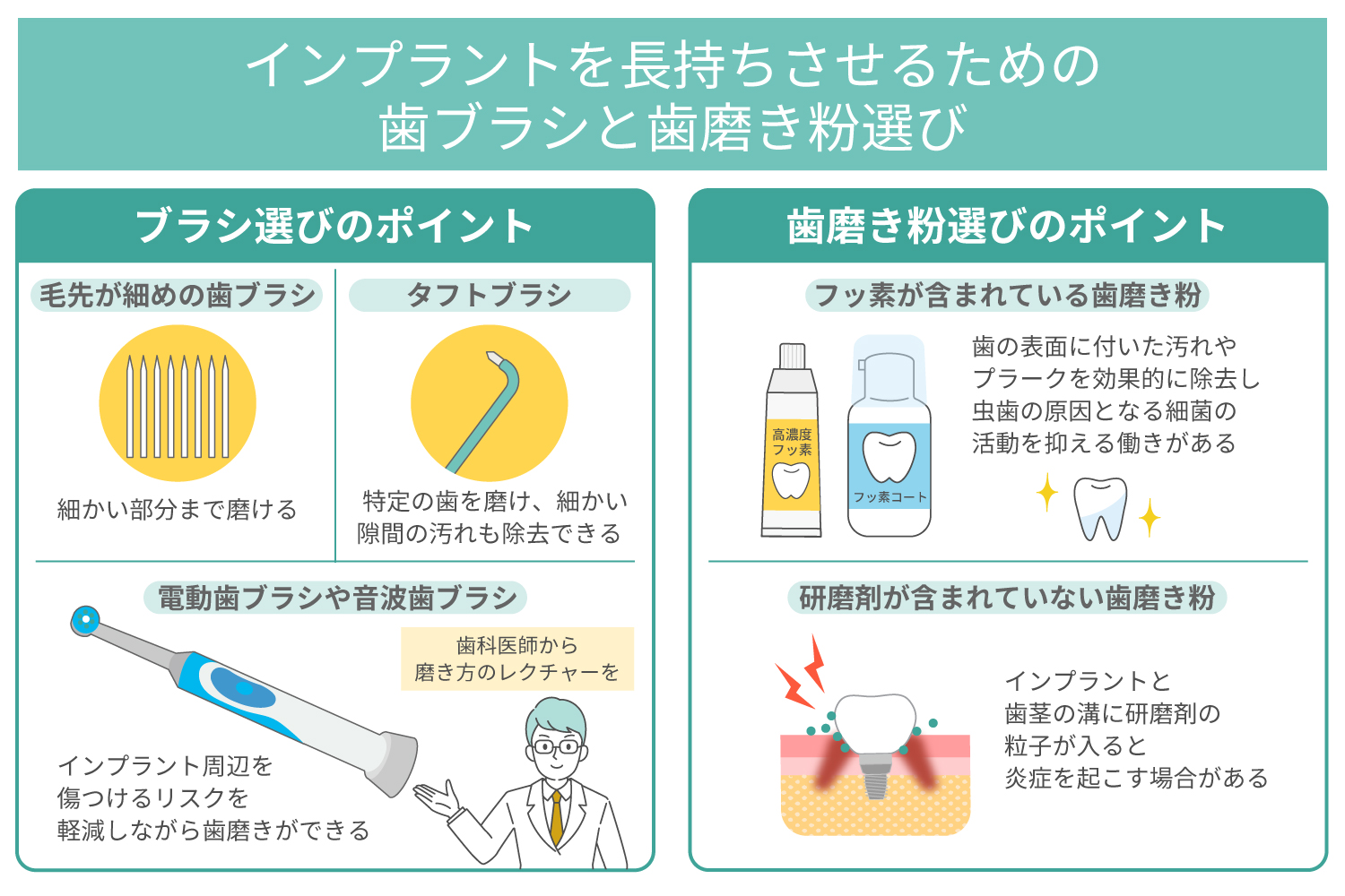 インプラントを長持ちさせるための歯ブラシと歯磨き粉選び