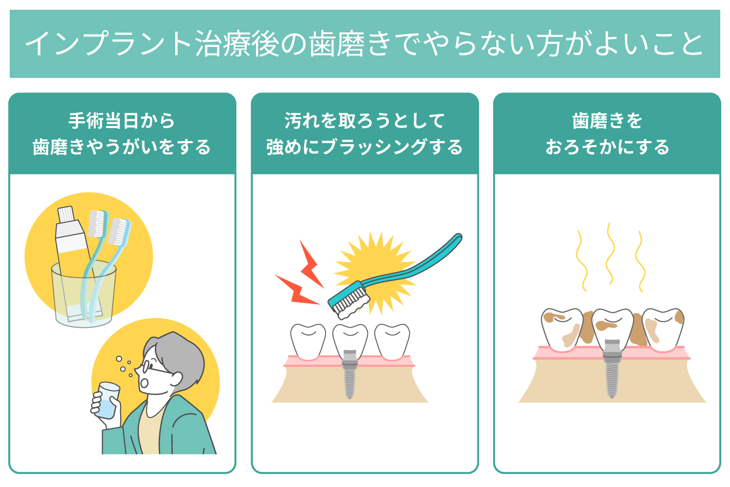 インプラント治療後の歯磨きでやらない方がよいこと