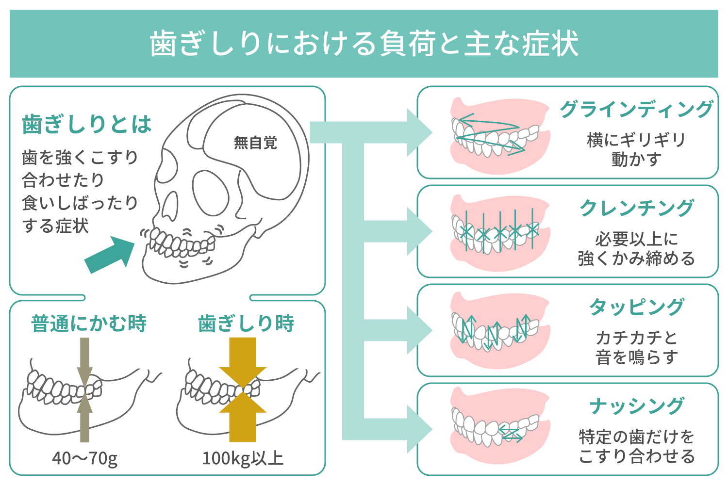 歯ぎしりとは？　どれくらい負荷がかかる？