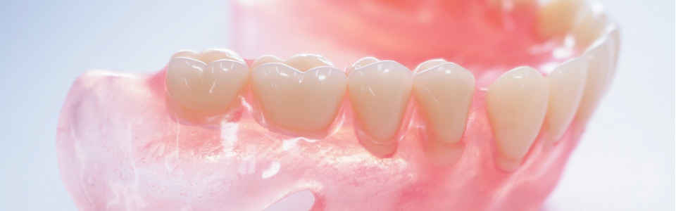 インプラントトラブルの対応策と予防策