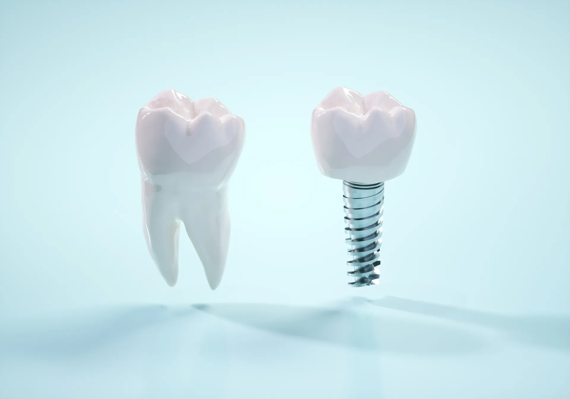 インプラント一本あたりの費用相場と費用負担を減らす方法を解説