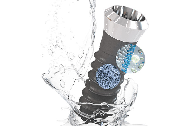 インプラントのイメージ