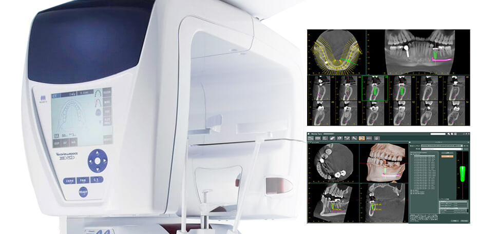 歯科用CT