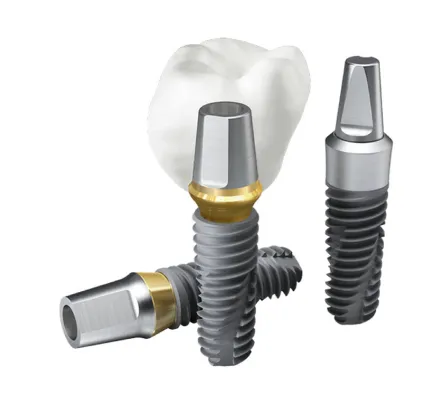 オステムインプラント(セラミックプラン)の価格